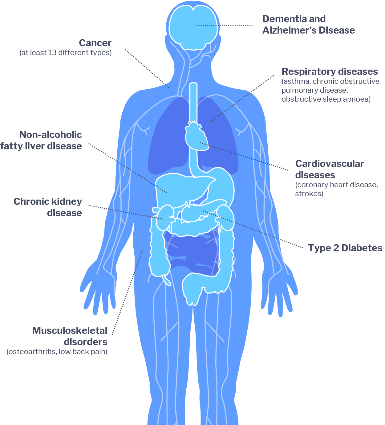 Why Use BMI?, Obesity Prevention Source